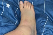 探讨篮球防守失误对脚骨折的影响（失误成为伤病源头，如何避免？）
