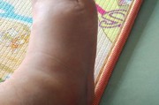 篮球防守对脚的伤害大吗？（揭秘篮球运动中脚部受伤的风险及预防措施）